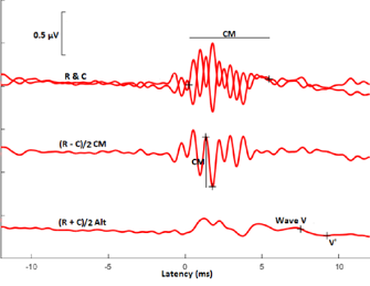 A hearing test in progress